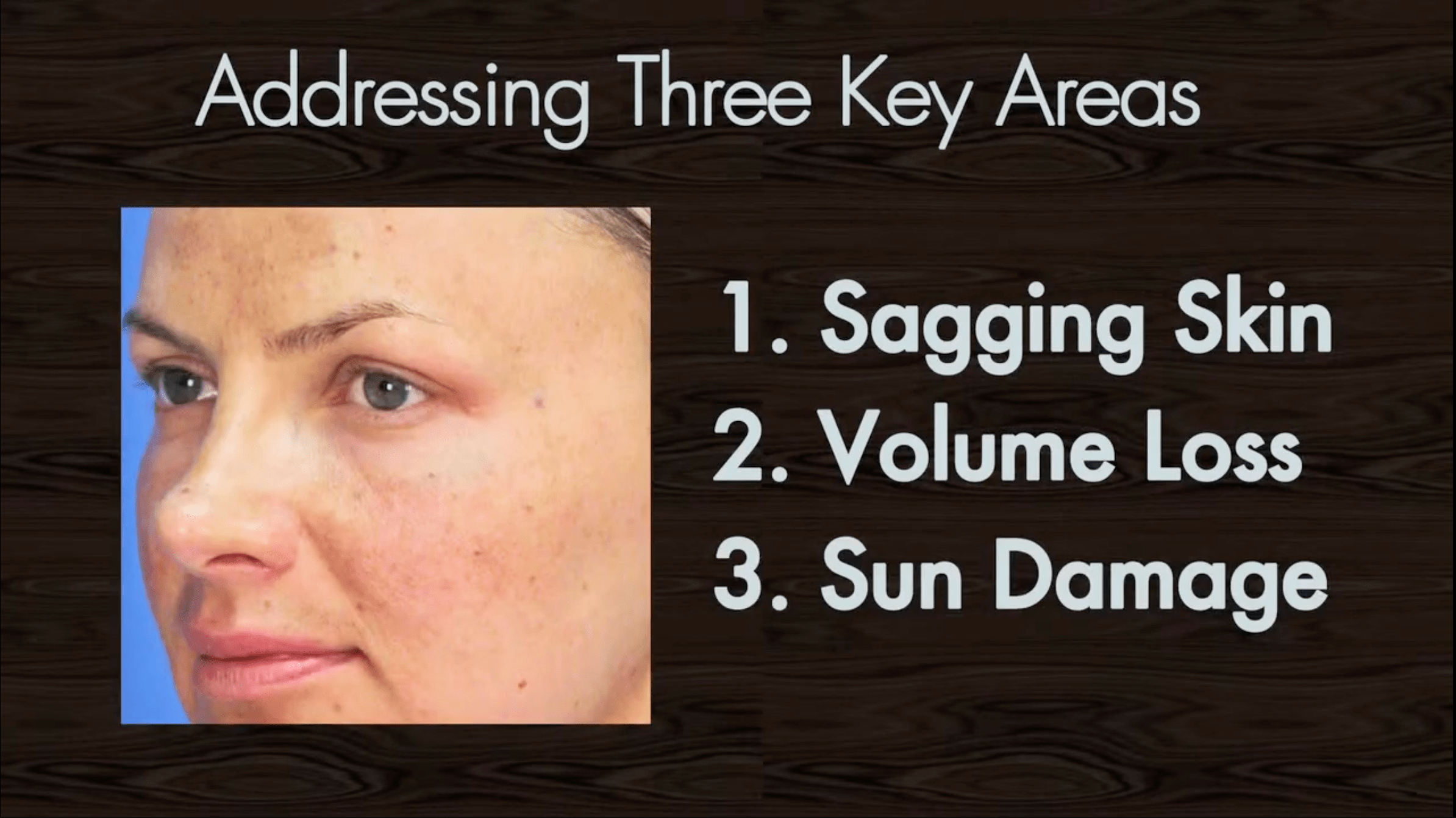 Addressing key areas