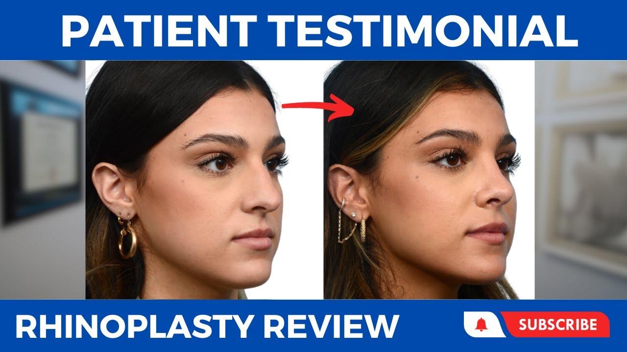 Rhinoplasty testimonial banner